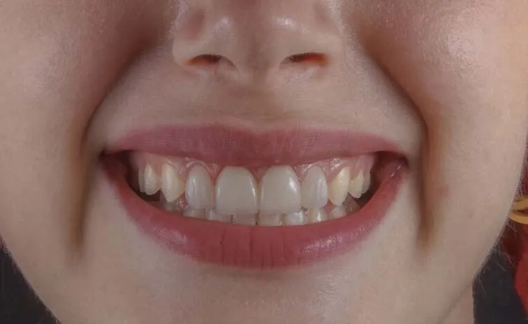 German Man Says Indians Have Good Dental Hygiene Goes Viral