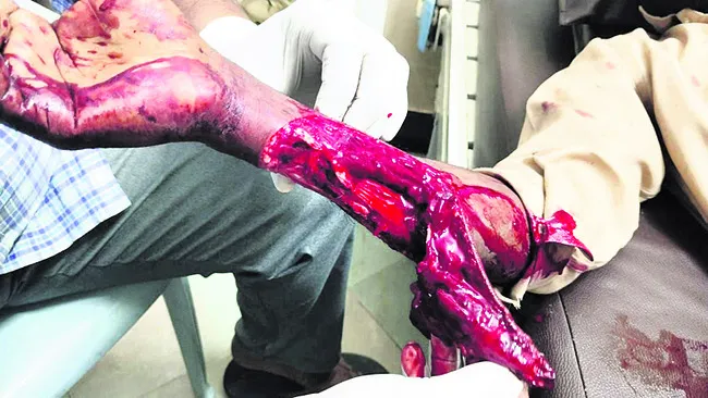 ఇసుక దిబ్బల కోసం తెలుగు తమ్ముళ్ల తగువులాట.!