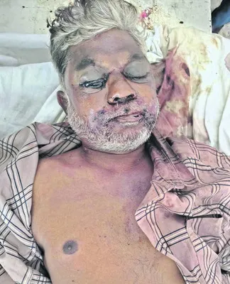వేర్వేరు ఘటనల్లో పలువురు మృతి