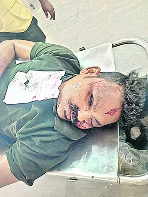 ప్రైవేట్ బస్సును ఢీకొన్న బైక్