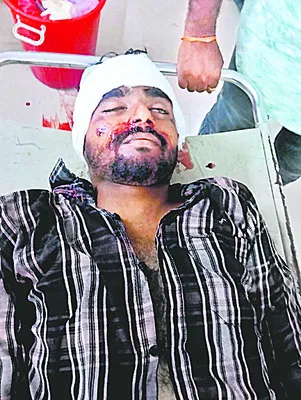 మూడు బైకులు ఢీ