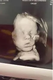 A Kentucky womans ultrasound is going viral On Social media4