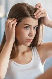 causes and remedies of Premature graying of hair8