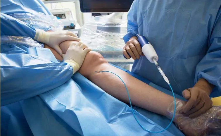 Health Tips: Sclerotherapy: Treatment for Varicose and Spider Veins3