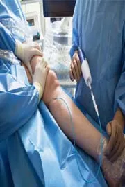 Health Tips: Sclerotherapy: Treatment for Varicose and Spider Veins2