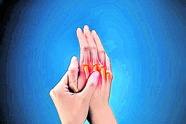 కీళ్ల