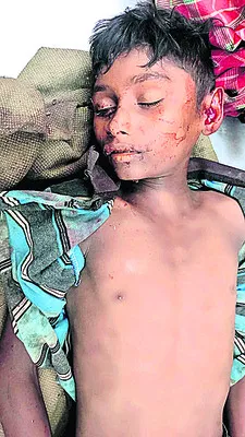 చింత చెట్టు పైనుంచి పడి బాలుడి మృతి