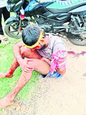 రోడ్డు ప్రమాదంలో ఇద్దరికి గాయాలు