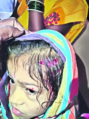 పిచ్చికుక్క దాడిలో పలువురికి గాయాలు