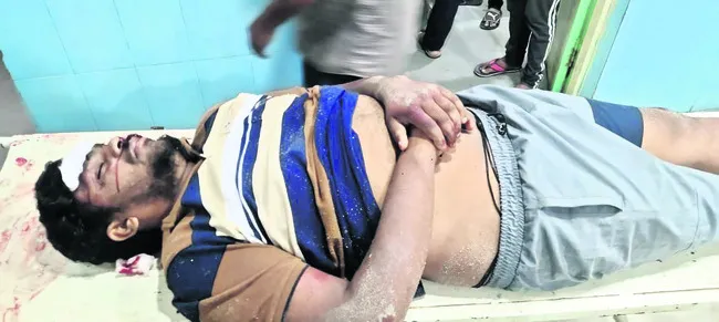 స్కూట