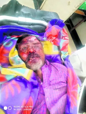 పాముకాటుతో మహిళ మృతి 