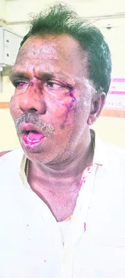 వైఎస్సార్సీపీ నేతపై దాడి