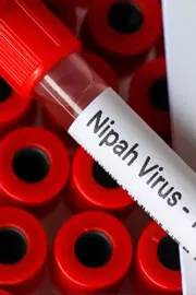 Nipah Virus Second Suspected Death Reported in Kerala6
