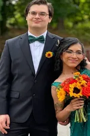 Conjoined Twin Carmen Andrade Gets Married Reveals About Wedding5