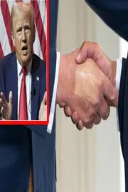 US president has been diagnosed with chronic venous insufficiency1