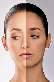 Shefali Jariwala: Anti ageing treatments glutathione and Vitamin C Cost9