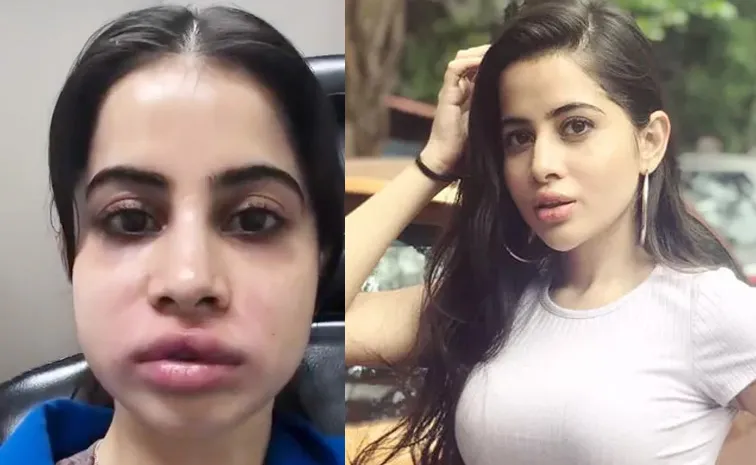 అంద విహీనంగా మారిపోయిన నటి ముఖం