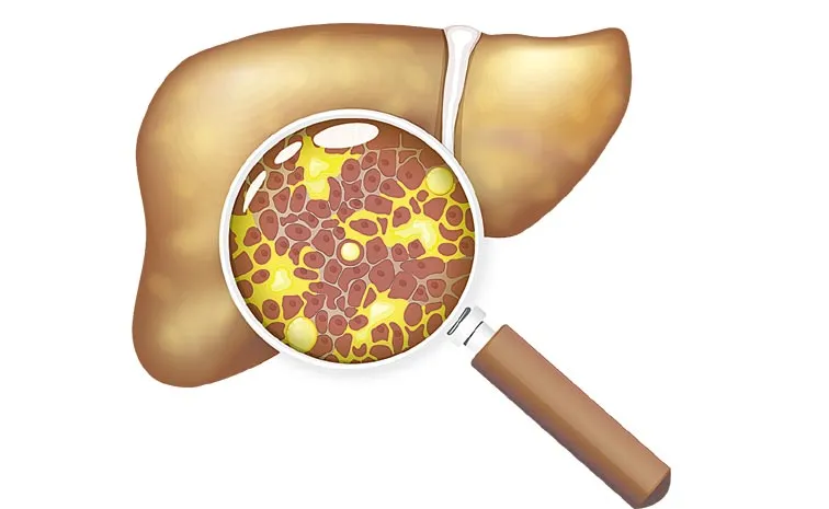 Heavy alcohol use can severely damage the liver