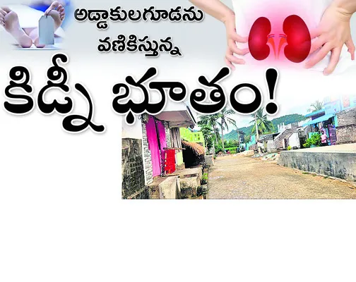 కిడ్న