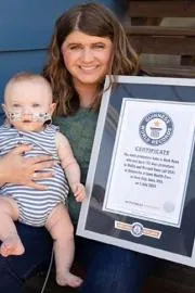 A little baby boy born just 21 weeks Sets Guinness World Record In USA6