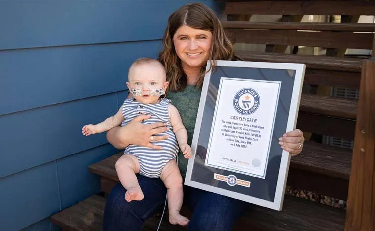 A little baby boy born just 21 weeks Sets Guinness World Record In USA5