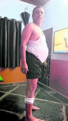 కొండ ముచ్చుల దాడి