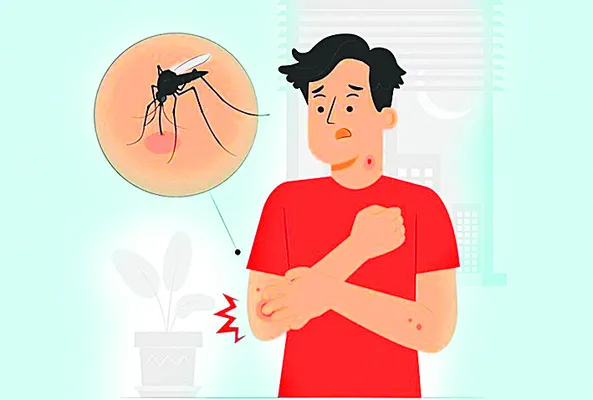 అప్రమ