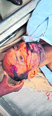 సోదరికి మాత్రలు తీసుకెళ్తుండగా..