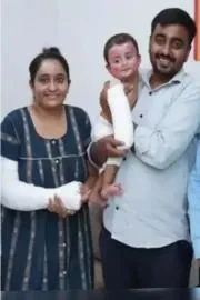 Mother rescued infant in Air India Incidentn donates skin for Son recovery4