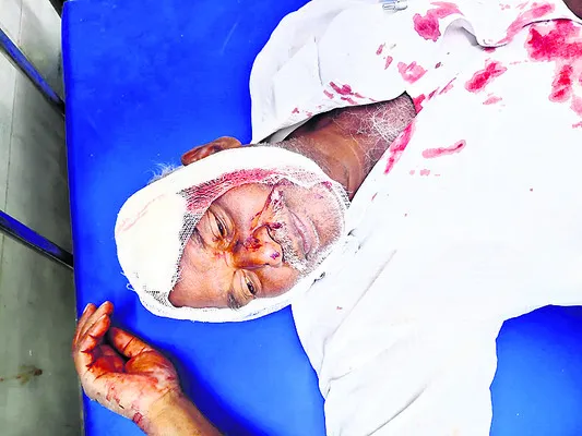 రోడ్డ