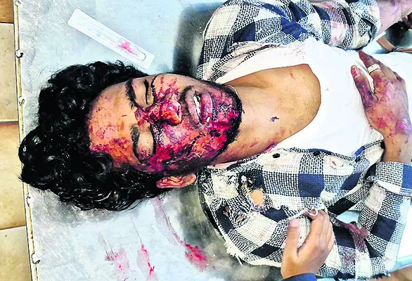 రైలు నుంచి పడి విద్యార్థికి తీవ్ర గాయాలు