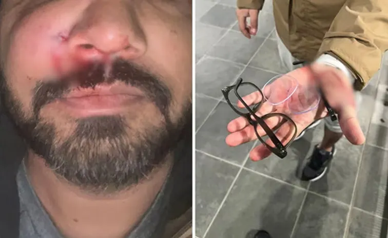 Indian Origin Unprovoked Racist Attack by Teenagers