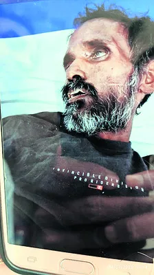 గాయపడ