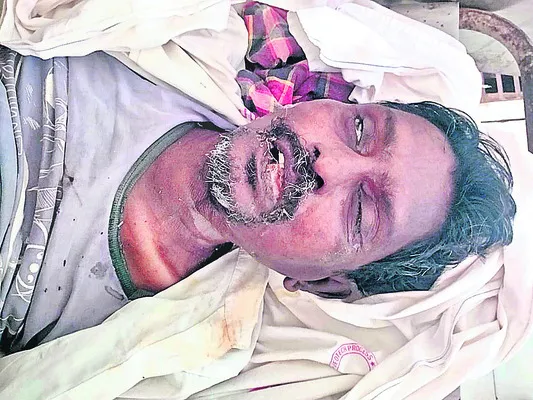 రిమ్స