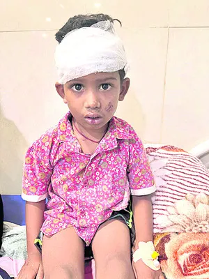 చిన్నారిపై వీధికుక్క దాడి