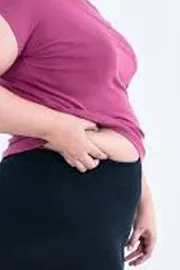 Hyderabad reveals alarming obesity rates says Weight gain trends 1