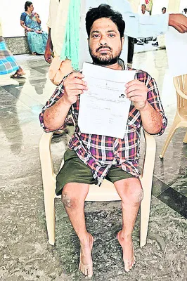 వైకల్