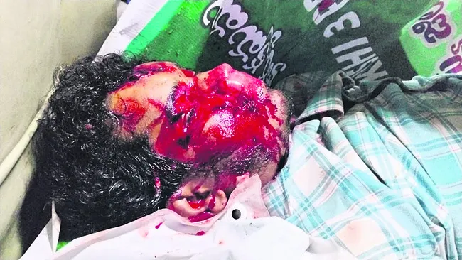 లారీ