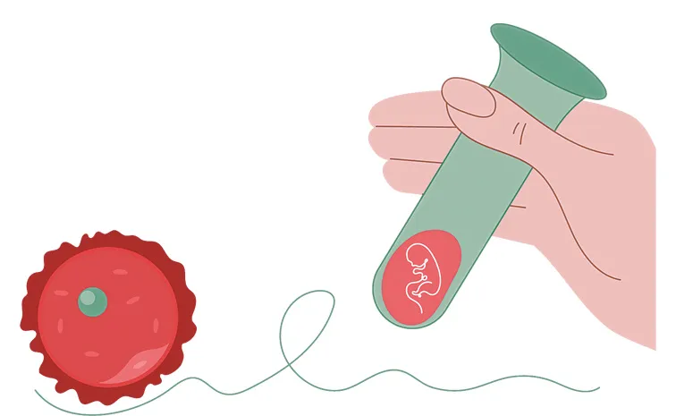 Special Feature Story On Test Tube Baby