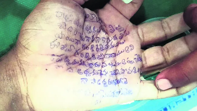 విషగు