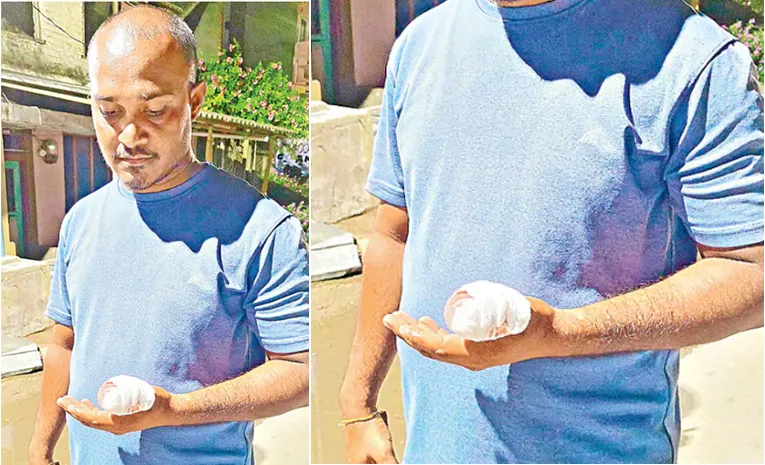 Constable Bit Youth Thumb Over Land Dispute