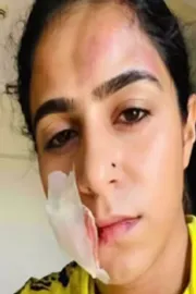 Jaseela Parveen: My Ex Boyfriend Kicked On My Stomach15