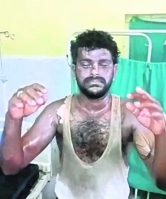చికిత్స పొందుతూ  వ్యక్తి మృతి 
