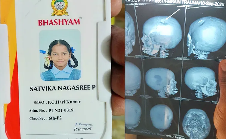 A private School Teacher Of Pungunuru Beats Student On Her Head