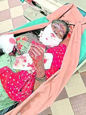 భార్యపై కత్తితో దాడి 
