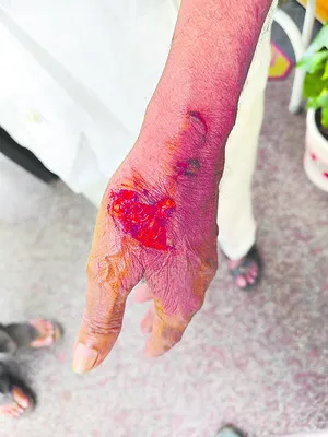 వాకిం