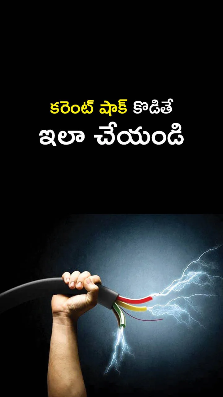  first aid treatment for Electric shock