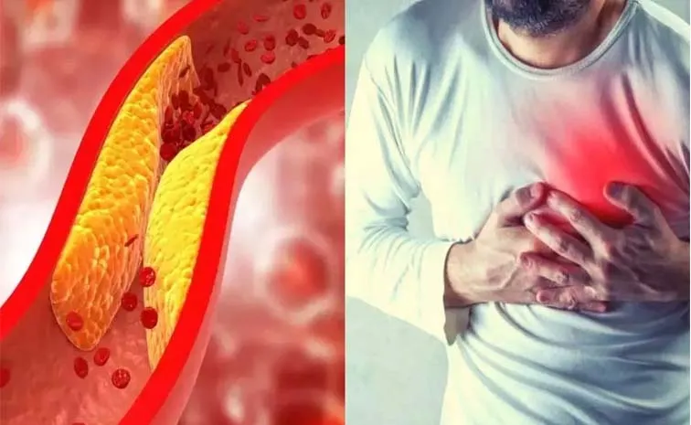 Health Tips: What to Know about Lipoprotein a And Risk Factors