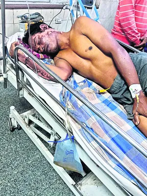 విద్యుత్ షాక్తో వ్యక్తికి తీవ్ర గాయాలు