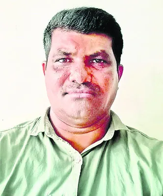 ఈ విధ